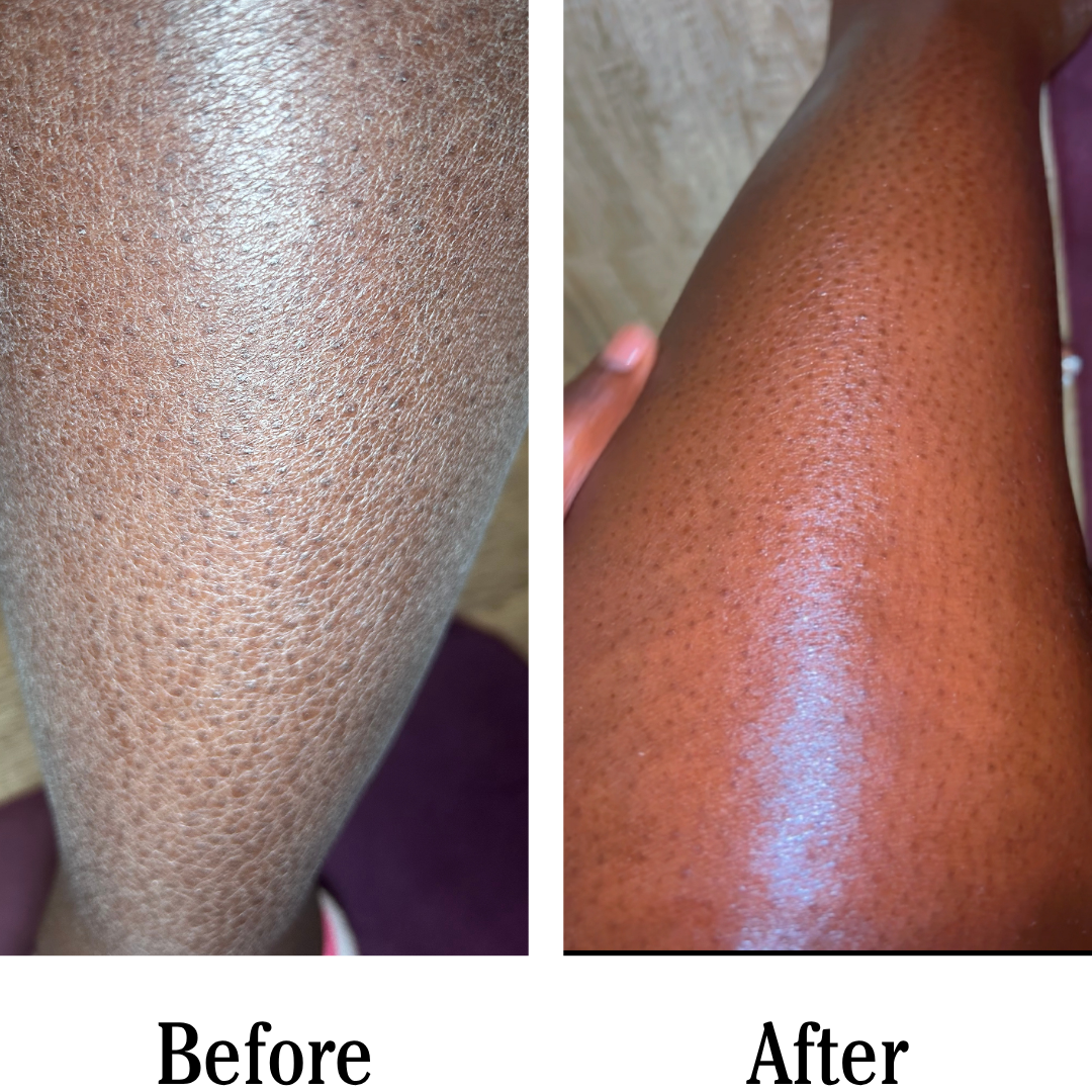 Before and after comparison of a person's leg with visible hair removal.